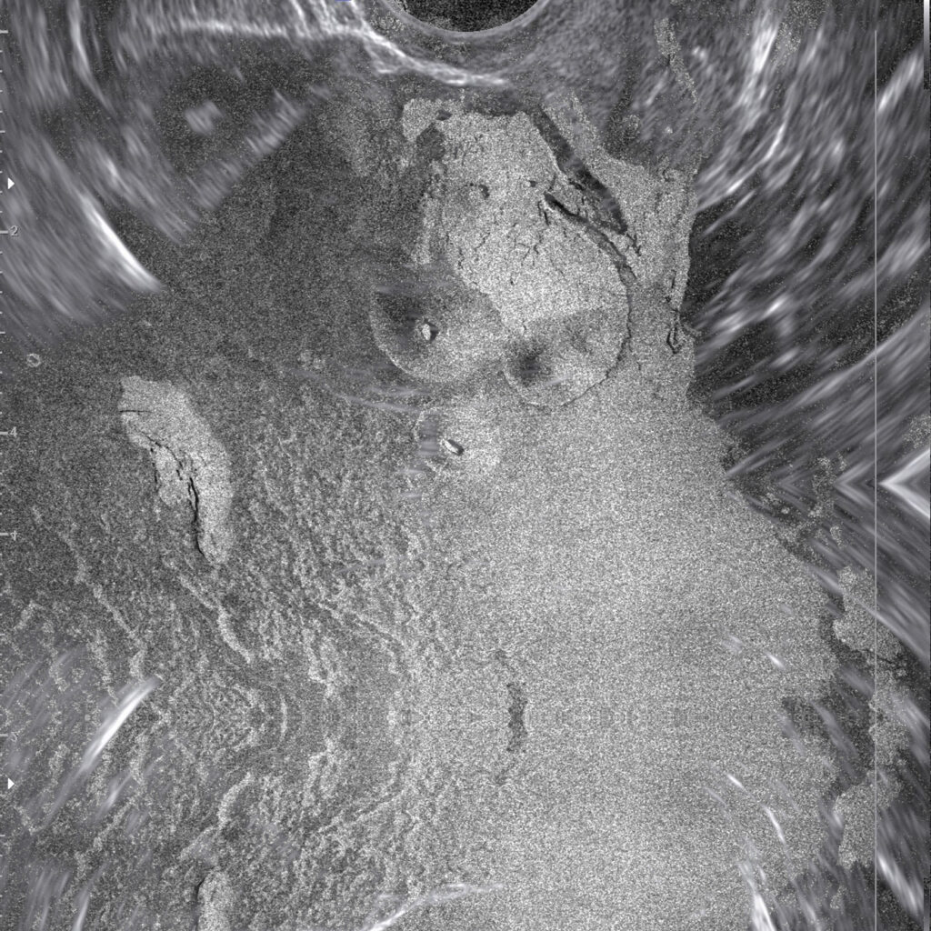 Étude corporelle No. 2 : Volcanic Domes and Sonograms, 2025.